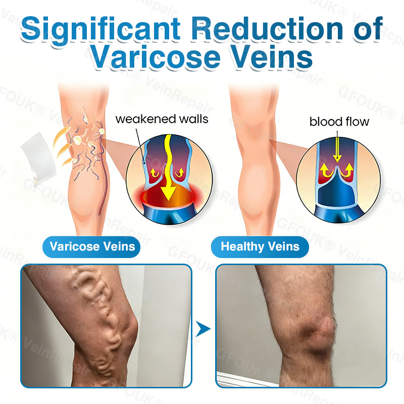 🇨🇦🏆✅️🏃Glownrst® VeinRepair Microneedle Patch Roll⚡Instant Relief, Long-Term Results