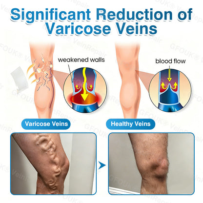 🇨🇦🏆✅️🏃Glownrst® VeinRepair Microneedle Patch Roll⚡Instant Relief, Long-Term Results