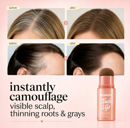⏰Last Day: Buy 1 Get 1 Free🎁 — Instantly Cover Roots, Grays & Sparse Hairlines