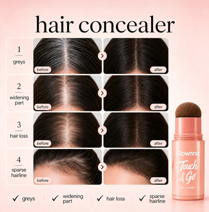 ⏰Last Day: Buy 1 Get 1 Free🎁 — Instantly Cover Roots, Grays & Sparse Hairlines